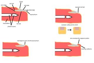 Female Infertility Causes and Treatment Ppt
