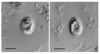 Icd 10 for Infertility