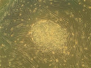 Infertility Support Articles