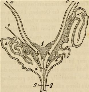 Pcos Infertility Options