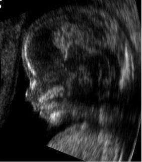 Infertility Doctors in Raleigh Nc