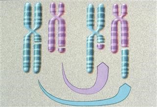 Infertility After Progesterone Injection