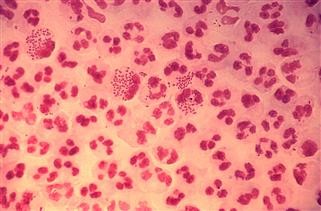Genetic Testing for Infertility Cost