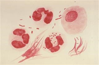 Infertility Test at Home