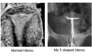 Infertility Clinic Atlanta