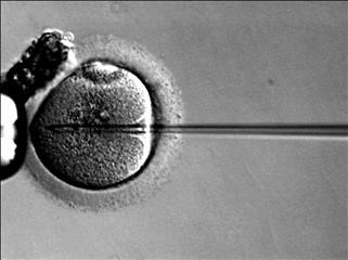 Infertility Exam Questions