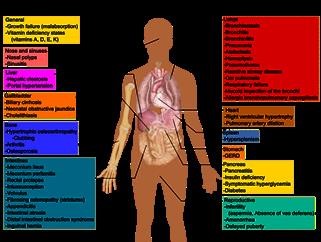 Infertility From Radiation Therapy