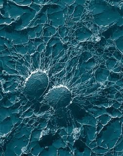 Unexplained Infertility and Icsi