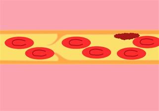 Unexplained Infertility Management
