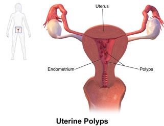 Infertility Treatment in Ramachandra Hospital