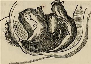 Does Birth Control Injection Cause Infertility