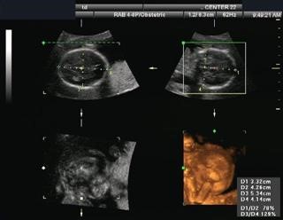 Infertility Center in Amritsar