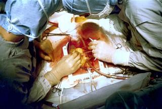 Infertility Associated Problems