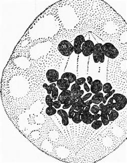 Unexplained Infertility and Baby Aspirin