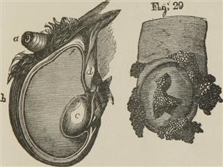 Infertility Treatments Fmla