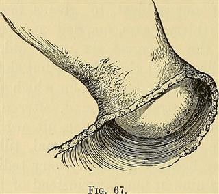 Nursing Diagnosis of Infertility in Females