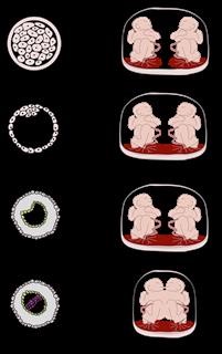 Female Infertility Blocked Fallopian Tubes