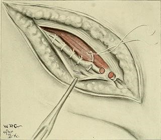 Global Infertility Causes