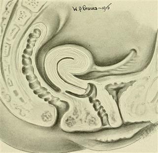 How Infertility Causes