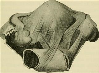 Infertility Form Images