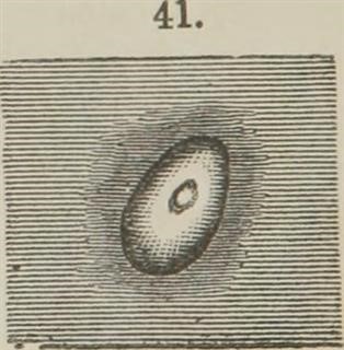 Compare and Contrast Infertility and Sterility