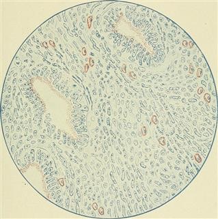 Infertility Clinic University of Minnesota