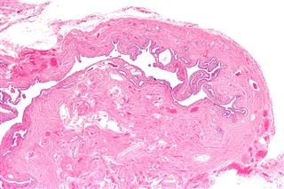 Infertility Issues in Dubai
