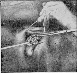 Common Causes of Female Infertility