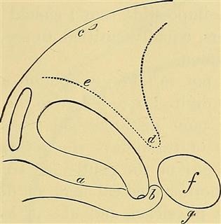 Primary Causes of Female Infertility