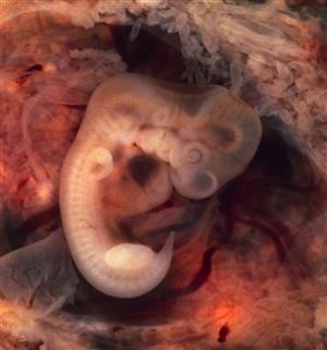 Infertility Fellowship in Hyderabad