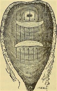 Pathophysiology of Infertility Pdf