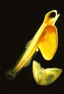 Infertility Problem in Female