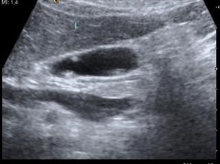 Infertility Medicine by Ramdev Baba