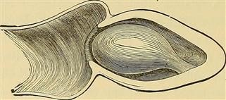Couple Infertility Prevalence