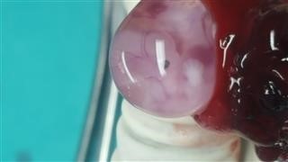 Books With Infertility