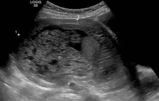Infertility Osce