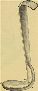 Peyronie's Disease Infertility