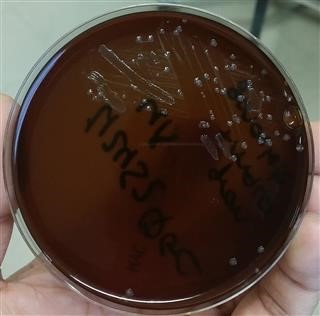 Infertility in Mandarin