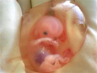 Infertility Doctors Cleveland Clinic