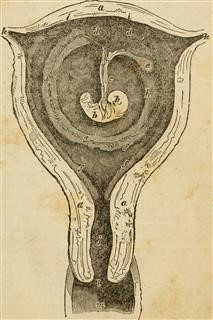 Unexplained Infertility Icd 10
