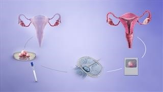 Paul Giamatti Infertility Movie
