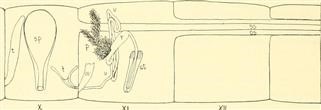 Infertility Reasons in Female