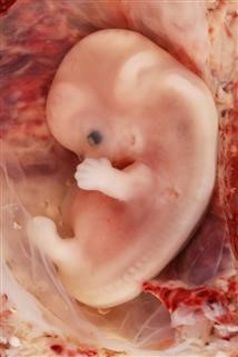 Define Unexplained Infertility