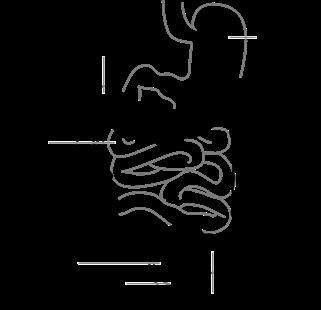 Infertility Us