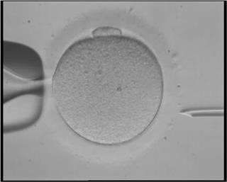 Ovarian Cancer and Infertility Drugs