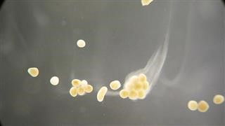 Incidence of Infertility in Pcos