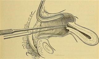 Infertility Blog Christian