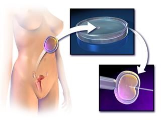 Infertility Rate in India 2017