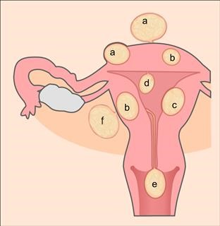 Blood Count Infertility